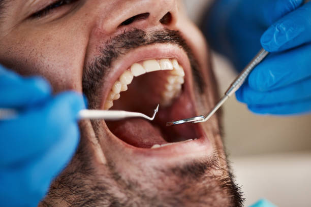 Best Pediatric Emergency Dentist in Greensboro, NC