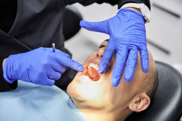 Best Emergency Dental Care for Abscessed Tooth in Greensboro, NC