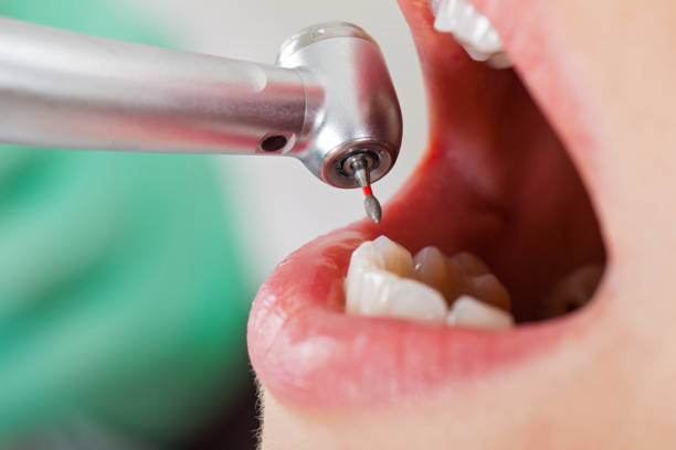 Best Orthodontic Emergency Dentist in Greensboro, NC